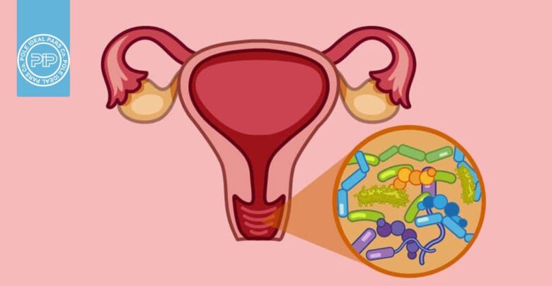 عفونت قارچی واژن: علائم، علل و روش جلوگیری و درمان آن چگونه است؟