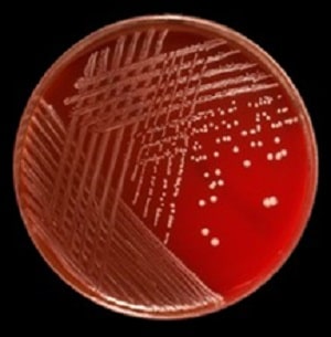 نمایی از باکتری S.epidermidis
