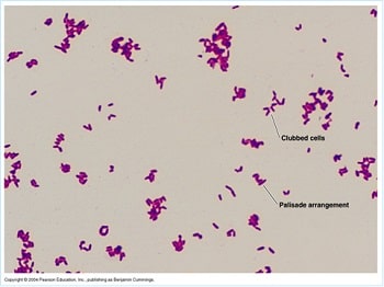 شکال گرزی و آرایش نردبانی و حروف‌چینی در رنگ‌آمیزی گرم کورینه باکتریوم دیفتریه