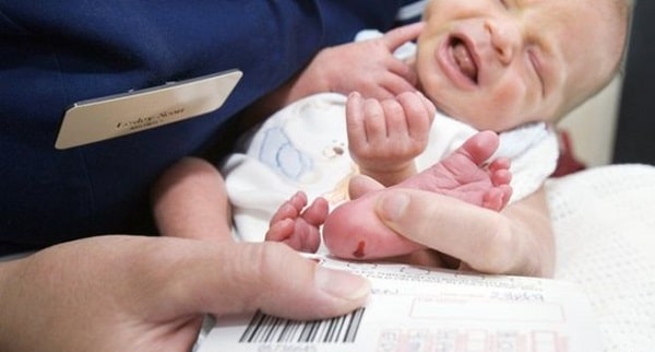 غربالگری غده‌ی تیروئید در نوزادان
