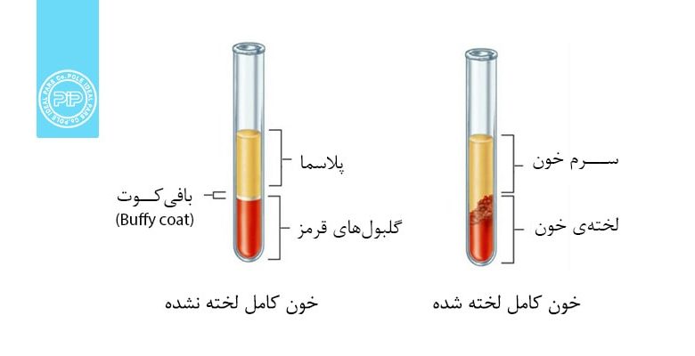 توضیح تفاوت سرم خون و پلاسمای خون