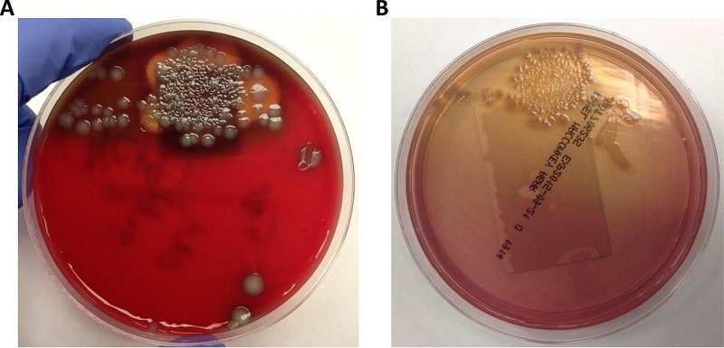 کلنی های پلزیوموناس شیگلوئیدس بر روی محیط ژلوز خوندار و مک کانکی