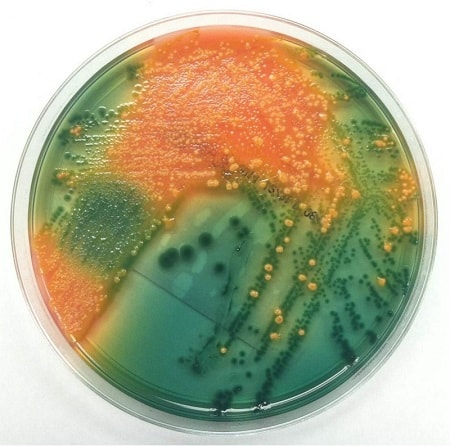 کشت نمونه ی مدفوع وکلنی های پلزیوموناس شیگلوئیدس در محیط هکتون انتریک آگار (کلنی های سبز رنگ پلزیوموناس شیگلوئیدس و کلنی های نارنجی رنگ فلور نرمال هستند)