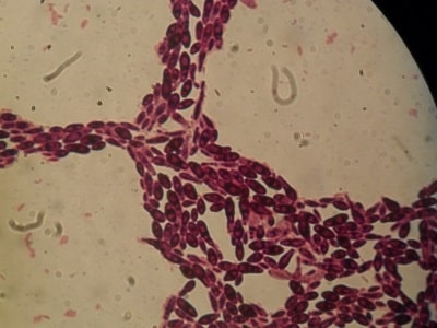 سلول‌های مخمری اگزوفیالا