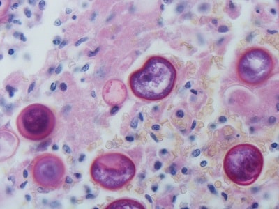 اسفرول های نابالغ کوکسیدیوئیدس (رنگ آمیزی پاس)