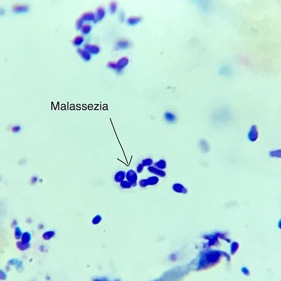 سلول‌های مخمری مالاسزیا