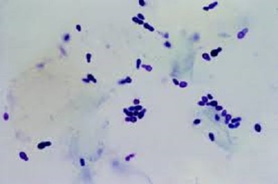 سلول‌های مخمری مالاسزیا