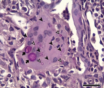 سلول های مخمری هیستوپلاسما کپسولاتوم درون سلول غول آسا