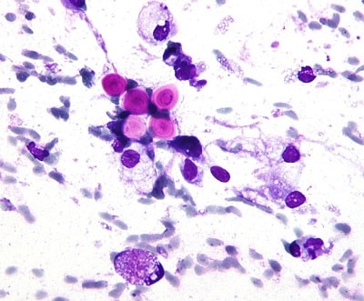 سلول‌های مخمری کپسول‌دار کریپتوکوکوس نئوفرمنس