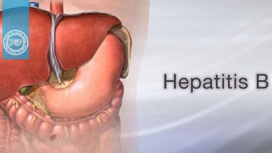 بیماری هپاتیت b