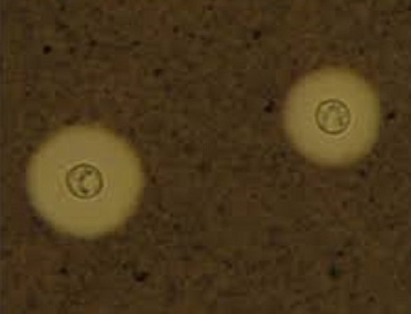 منظره میکروسکپی کریپتوکوکوس نئوفرمنس در آزمایش مرکب چین
