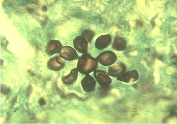 پاراكوكسیدیوئیدس برازیلینسیس