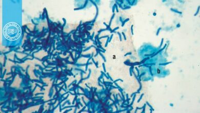 سه راه برای اصلاح محلول پتاس برای آزمایش های میکروسکپی قارچ شناسی