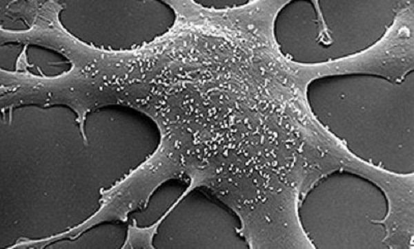 میکروگراف الکترونی روبشی مایکوپلاسما متصل به غشای فیبروبلاست های انسانی