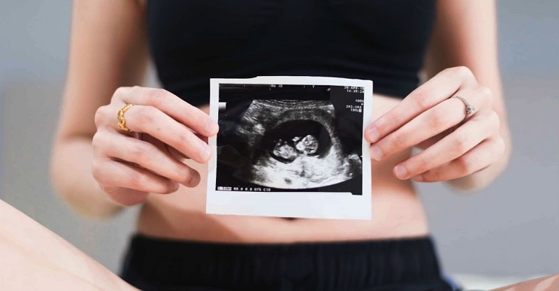 سونوگرافی تخصصی برای تشخیص بارداری پرخطر