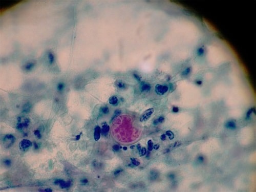 قارچ کوکسیدیوئیدس که با رنگ H&E (هماتوکسیلین ائوزین) رنگ آمیزی شده است.