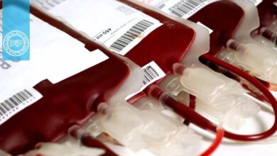 مصون نگه داشتن خون گرفته شده در انتقال خون از انگل بابزیا