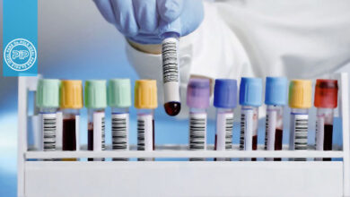 انواع افزودنی‌های لوله جمع آوری خون در آزمایشگاه و کاربرد هریک