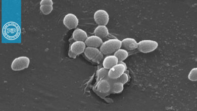آشنایی با باکتری انتروکوک فکالیس: مشخصات، بیماری‌زایی و تشخیص آزمایشگاهی