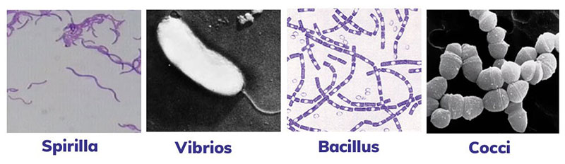 اشکال گوناگون باکتری ها