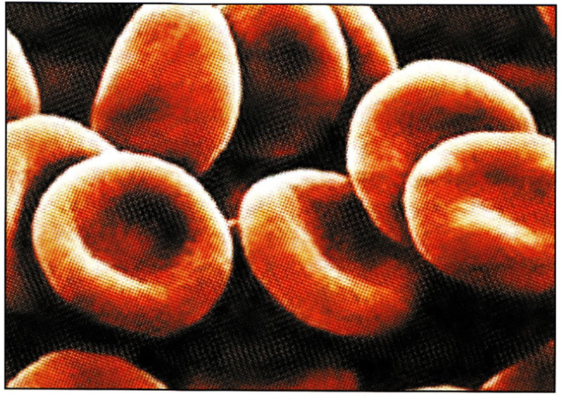 گلبول‌های قرمز طبیعی در زیر میکروسکوپ الکترونی