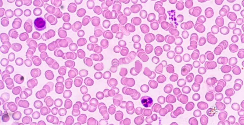 خون و سلول‌های خونی زیر میکروسکوپ