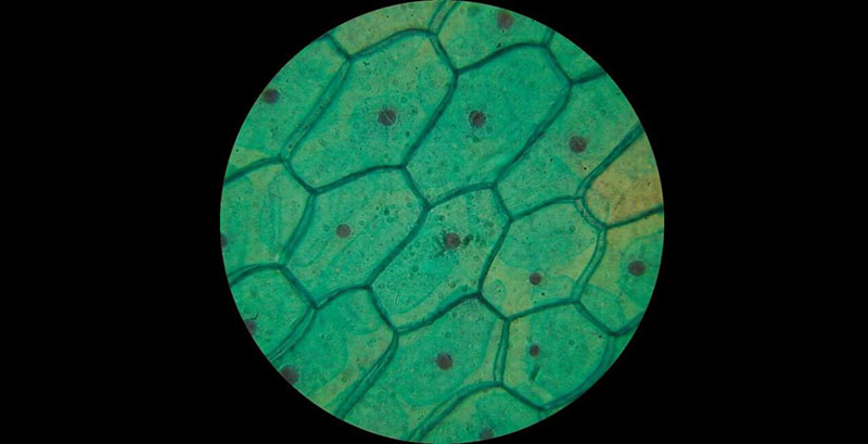 سلول گیاهی زیر میکروسکوپ