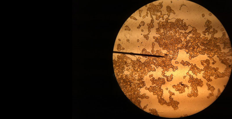مشاهده گرده زیر میکروسکوپ
