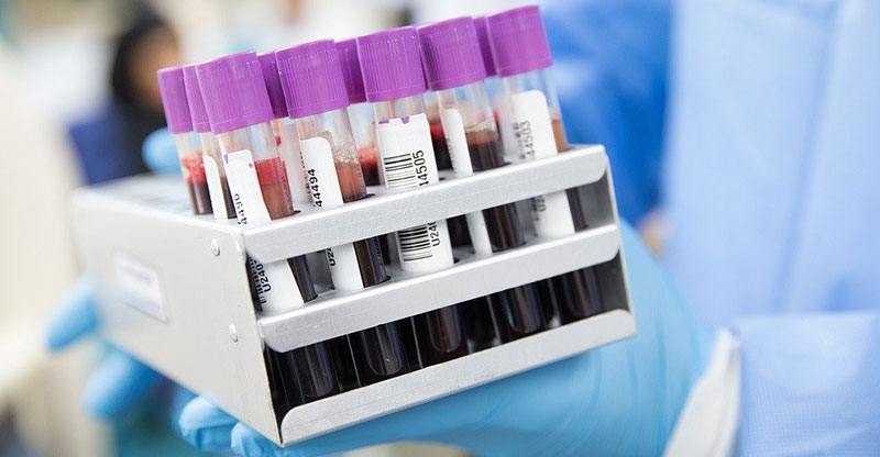 همولیز خون، یک خطای پیش تحلیلی رایج