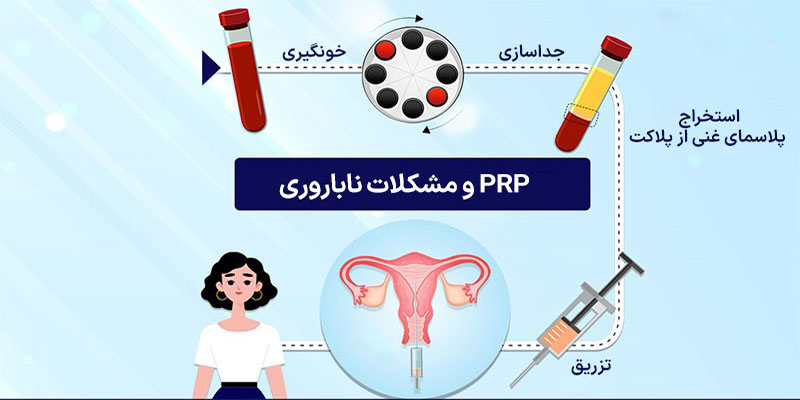 PRP در پزشکی باروری