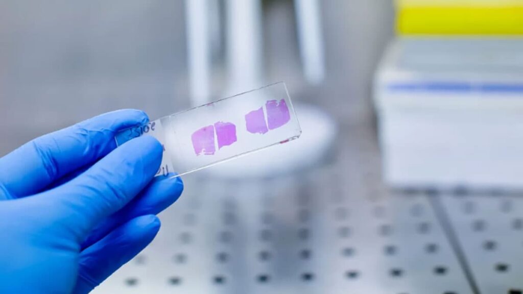 مراحل تهیه لام چگونه یک نمونه را روی لام آماده می‌کنید مجله پل ایده