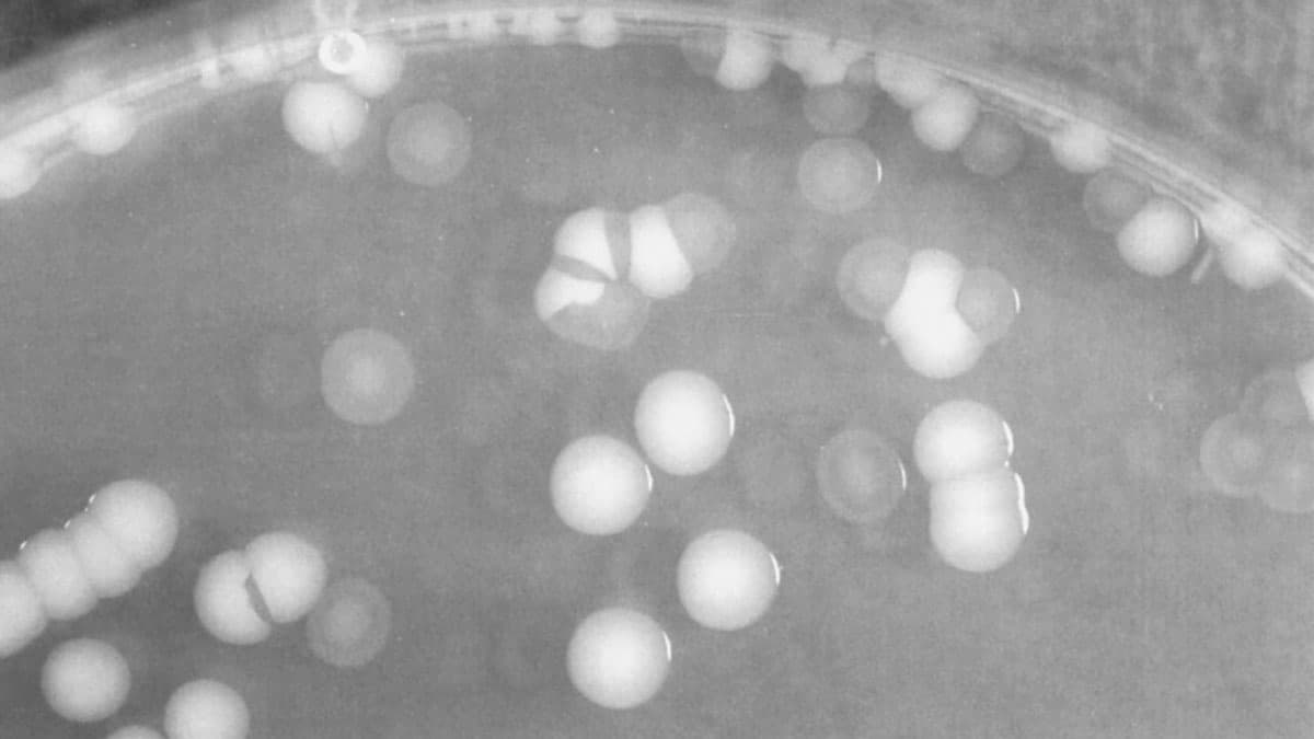 بررسی کدورت و شفافیت در مورفولوژی کلنی باکتری