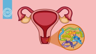 عفونت قارچی واژن: علائم، علل و روش جلوگیری و درمان