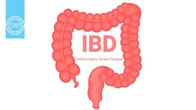 همه چیز دز مورد بیماری التهابی روده یا IBD