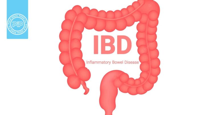 همه چیز دز مورد بیماری التهابی روده یا IBD