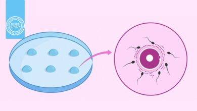 آشنایی با مراحل IVF : لقاح آزمایشگاهی چیست؟