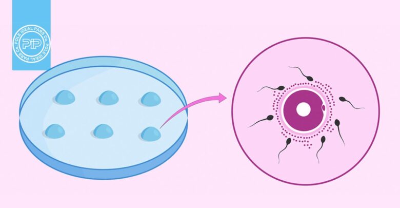 آشنایی با مراحل IVF : لقاح آزمایشگاهی چیست؟