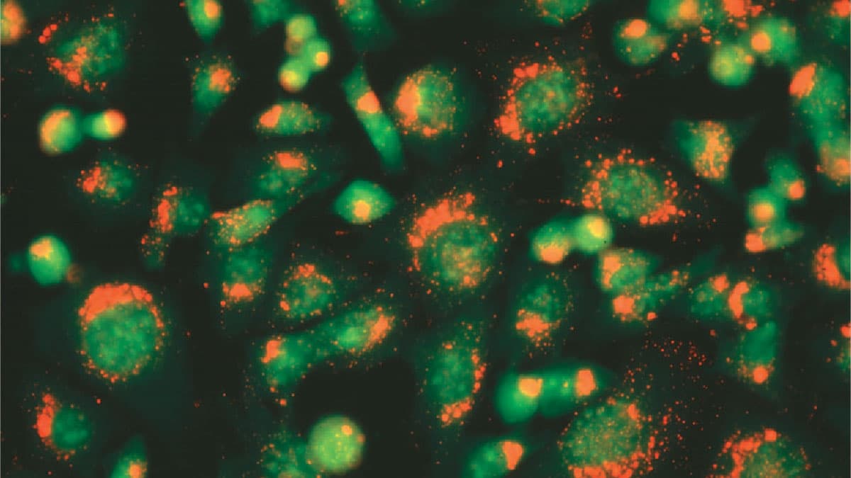 تصویر فلورسانس سلول‌های استئوسارکوم زنده موش در معرض AO