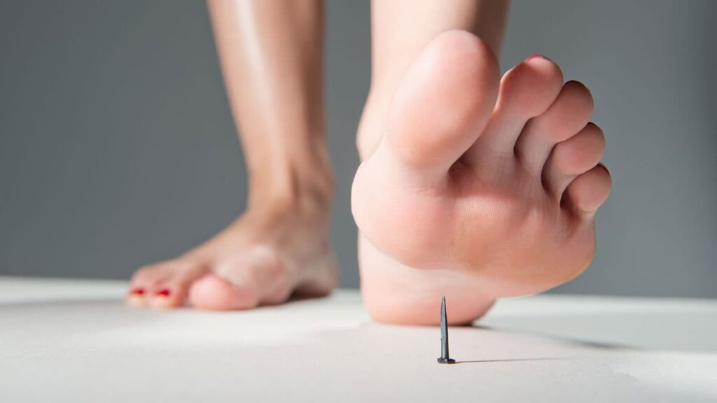 کلستریدیوم تتانی : بیماریزایی و تشخیص آزمایشگاهی - مجله پل ایدهآل پارس