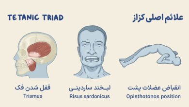 کلستریدیوم تتانی : بیماریزایی و تشخیص آزمایشگاهی - مجله پل ایدهآل پارس