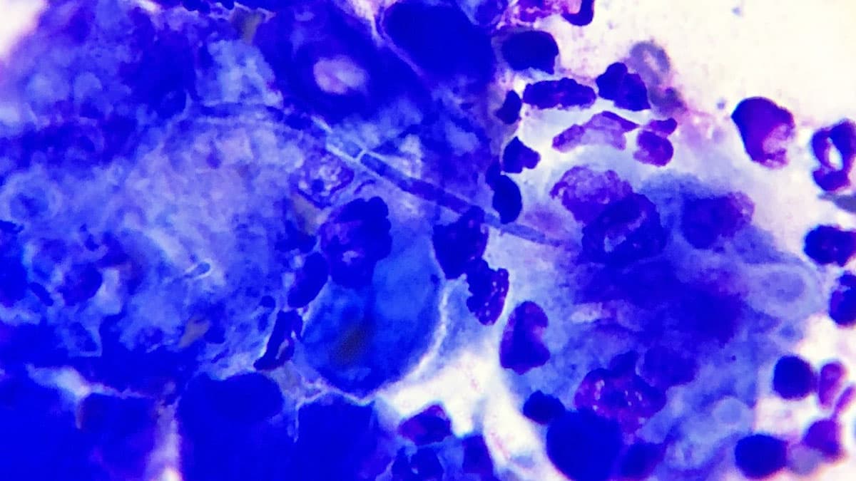 تکنیک رنگ‌آمیزی رومانوفسکی برای سلول‌های خونی