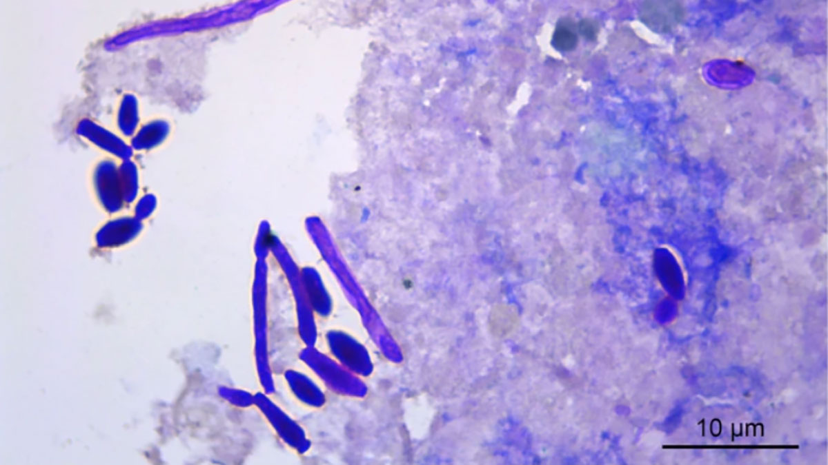 ورفولوژی سلول های مخمر مانند پس از رنگ آمیزی PAS