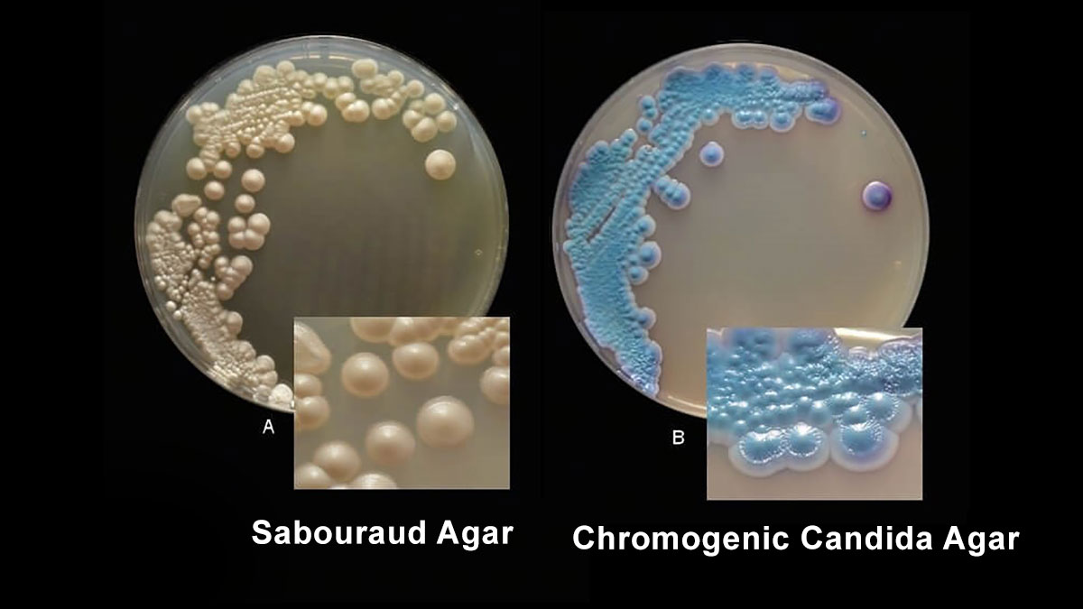 Candida tropicalis روی Sabouraud agar و Chromogenic candida agar