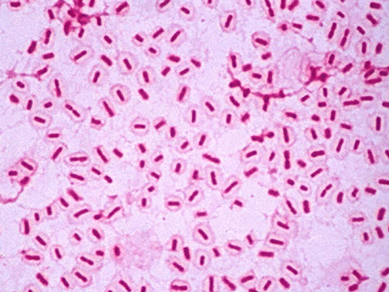 هموفیلوس آنفولانزا نوع بی (Hib)