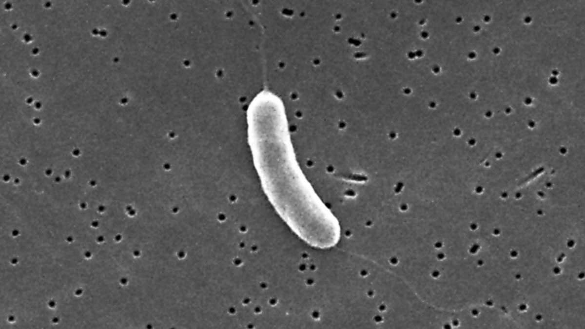 منابع مسمومیت غذایی ناشی از E.coli