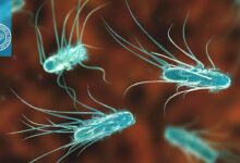 مسمومیت غذایی ناشی از E.coli