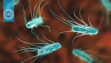 مسمومیت غذایی ناشی از E.coli