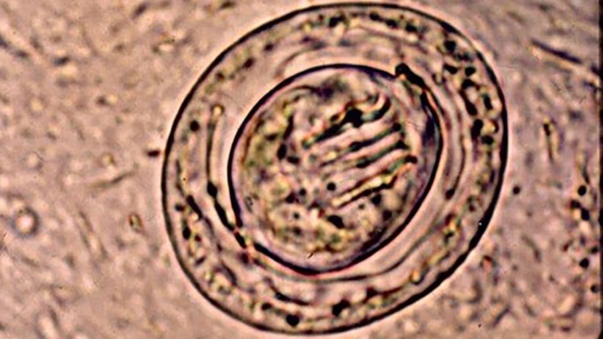 تخم Hymenolepis nana