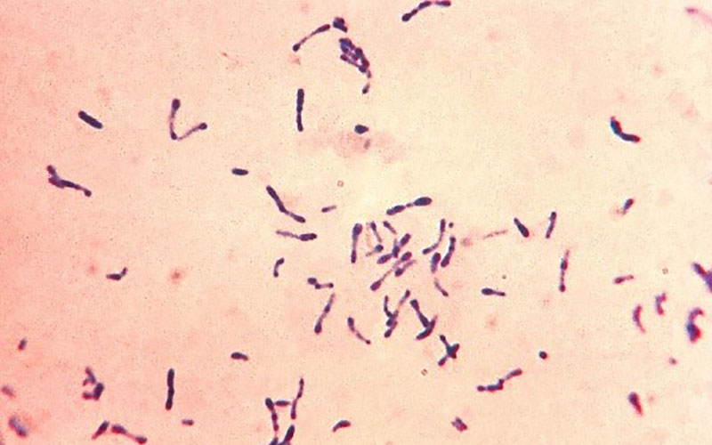 Corynebacterium striatum