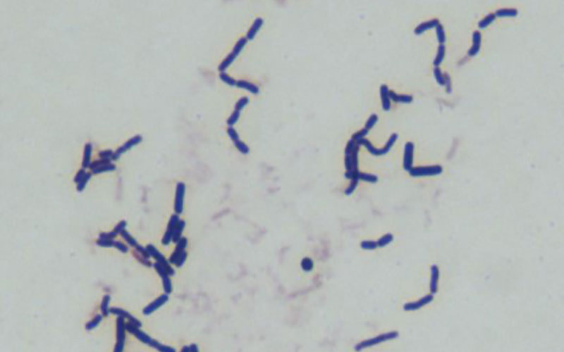 Corynebacterium xerosis